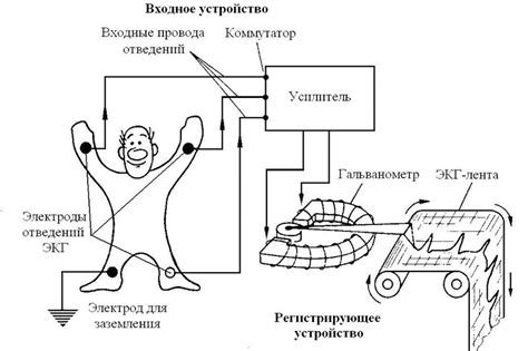 Экг схема наложения электродов фото на человека