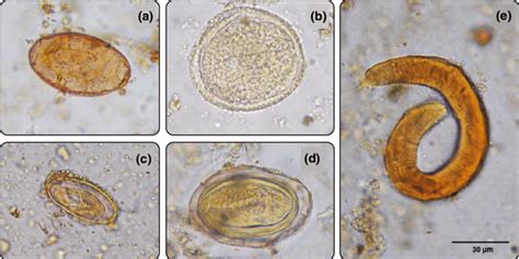 Helminth Eggs And Larvae At 400 Magnification Found In Felidae