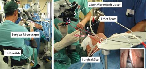 1 Surgical Setup For Transoral Laser Microsurgery Because Of The Download Scientific Diagram