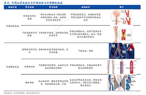 归创通桥——神经介入外周介入双轮驱动，未来可期财经频道证券之星