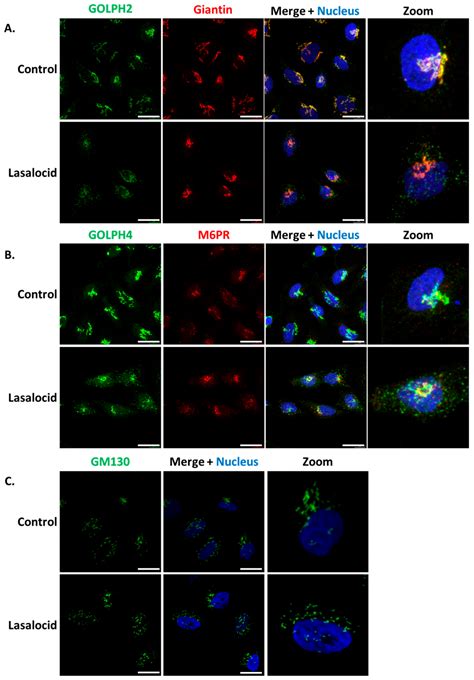 Toxins Free Full Text Revisiting Old Ionophore Lasalocid As A Novel