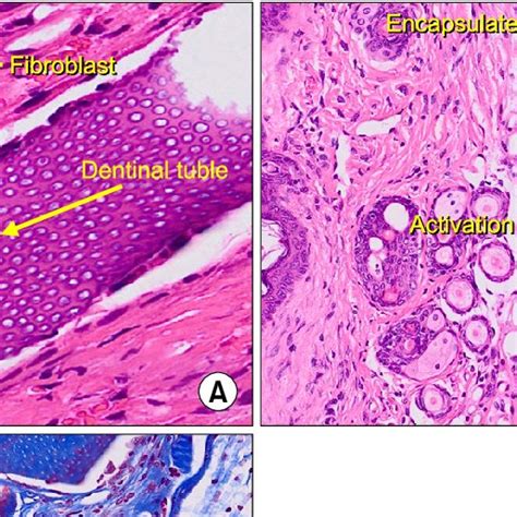 A Histological Finding Of Demineralized Dentin Matrix Ddm After