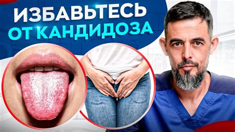 4 способа избавиться от молочницы РАЗ и НАВСЕГДА Youtube