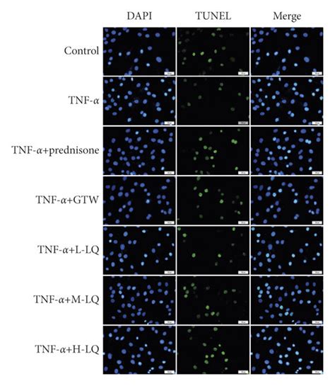 Lq Action On Rasf Cell Proliferation Was Detected Using Edu Assay And