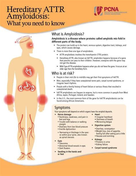 Risk Factors And Precautions For Amyloidosis Ask The Nurse Expert