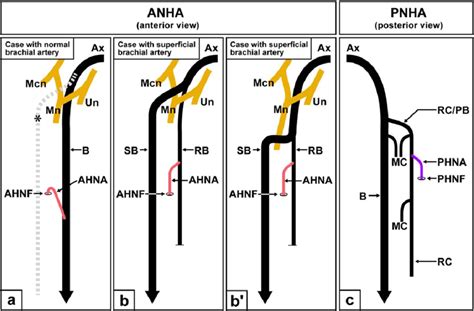 The Direction Of Humeral Nutrient Arteries A Typical Ahna In An Arm