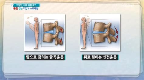 종합 무엇이든 물어보세요 허리통증 어깨통증 종아리통증의 무서운 원인 방치하면 괴사나 돌연사 치매 위험 증가