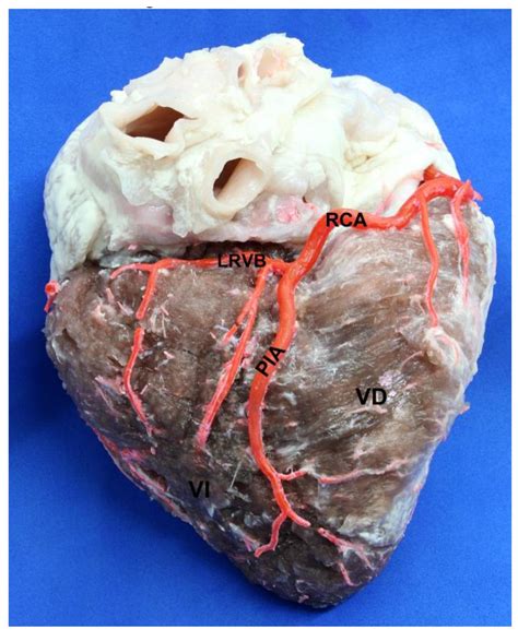 SciELO Brasil Evaluation Of Coronary Dominance In Pigs A