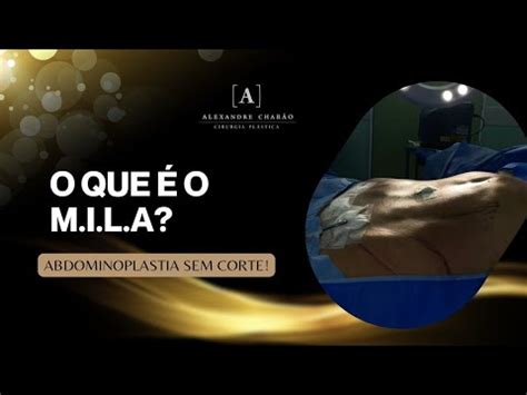 O Que O M I L A Abdominoplastia Sem Corte Dr Alexandre Char O