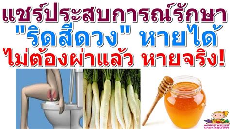 แชร์ประสบการณ์รักษา ริดสีดวง หายได้ ไม่ต้องผ่าแล้ว หายจริง! Disease ...