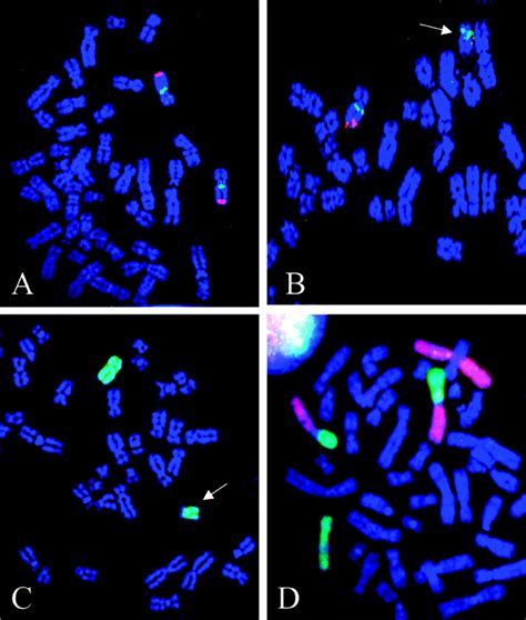 A Dual Colour Red And Green Fluorescence In Situ Hybridization