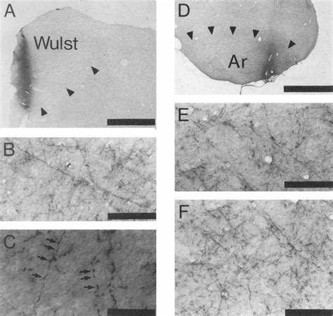 Photomicrographs Presenting Examples Of Results From Anterograde