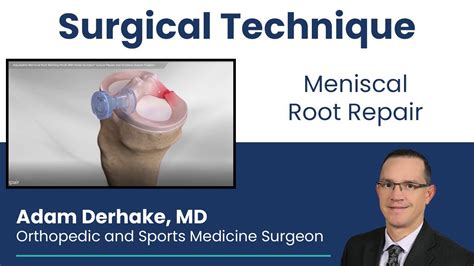 Meniscal Root Repair Surgical Technique YouTube