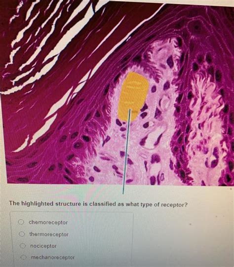 Solved The Highlighted Structure Is Classified As What Type Chegg