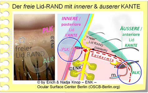 D Berblick Ber Den Lidrand Ocular Surface Center Berlin