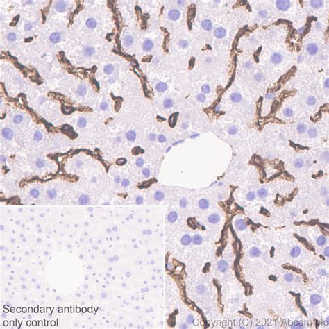 Recombinant Anti-LYVE1 antibody [RM1008] (ab281587) | Abcam