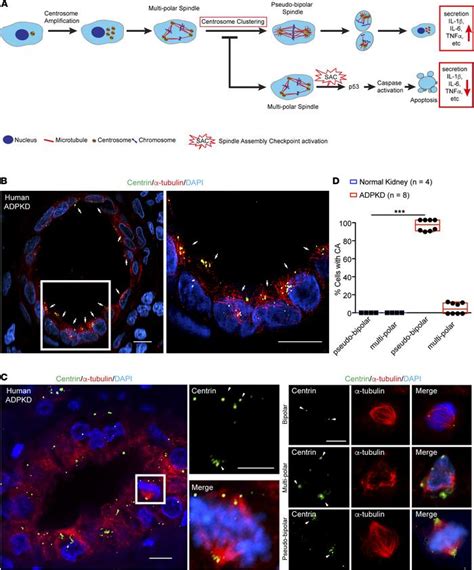 Jci Insight Inhibiting Centrosome Clustering Reduces Cystogenesis And