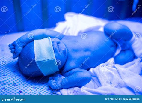 Newborn Having A Treatment For Jaundice Under Ultraviolet Lamp In Home