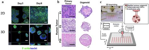 3D Bioprinting Of Disease And Cancer Models A Cytoskeleton Staining