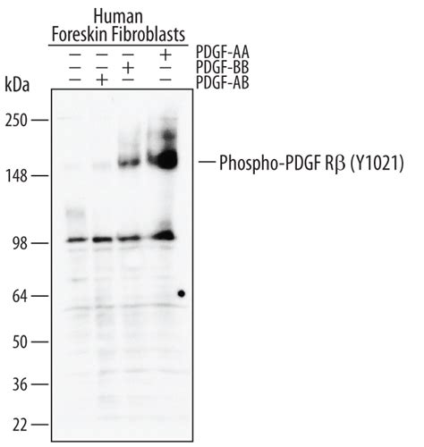 Human Pdgf R Beta Antibody Af R D Systems