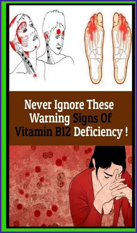 Never Ignore These Warning Signs Of Vitamin B12 Deficiency Artofit