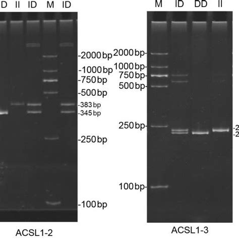 Schematic Expression Of The ACSL1 Gene And Location Of Identified