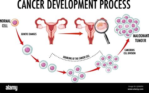 Diagrama Que Muestra Las C Lulas Normales Y Cancerosas En La