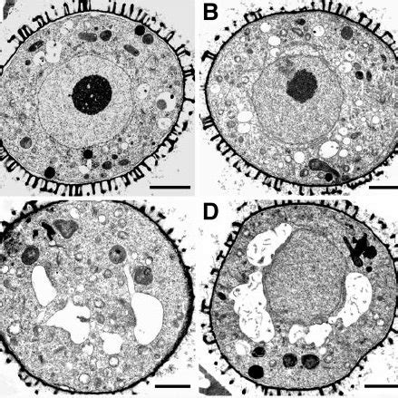 Transmission Electron Micrographs Of Wild Type No O A And C And