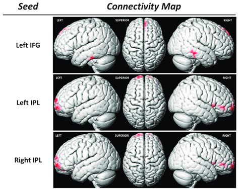 Functional Connectivity Fc Analysis Using The Seed To Voxel Approach Download Scientific