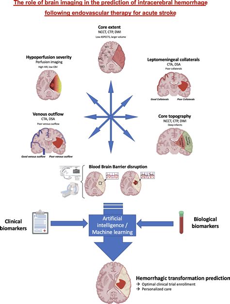 Role Of Brain Imaging In The Prediction Of Intracerebral Hemorrhage