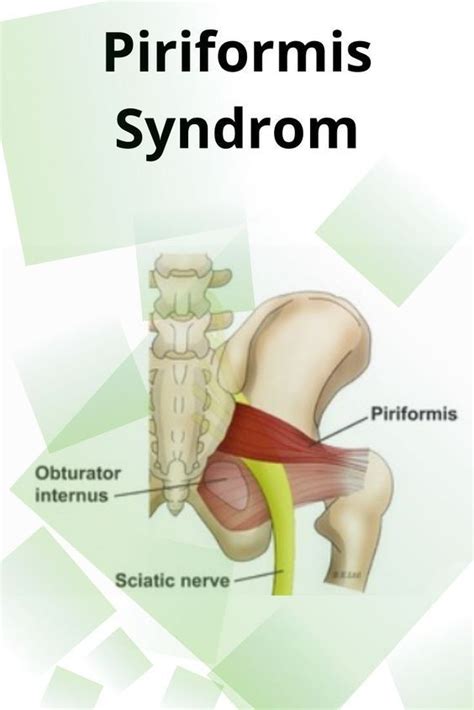 Piriformis Und Ischiadicus Der Muskel Um Den Es Heute Geht Startet An