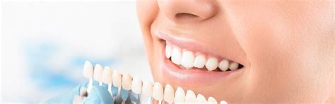 Best Dental Veneers in India | Veneers Cost in Delhi, India - Goel Dental