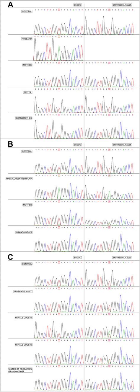 TAZ Sequencing Electropherograms Showing Position 83 Of The Coding DNA