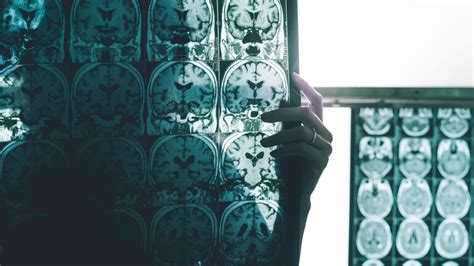 El Desnudo De Miley Cyrus Para Otra Producci N De Fotos Hot Infobae