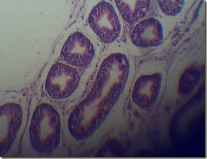 Histology Slides Database: Stereo cilia high magnified under microscope