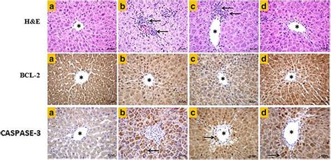 The Rat Liver Sections Of Experimental Groups A In The Control