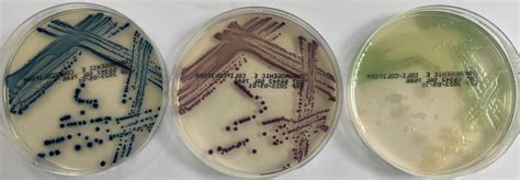 Chromogenic E Coli Coliform Plates Southern Group Laboratory