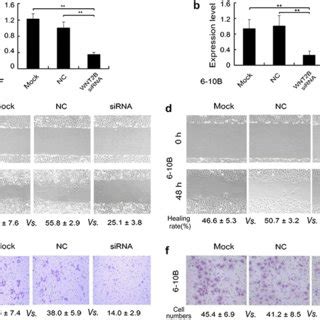 Silencing Expression Of Wnt B Suppresses Migration And Invasion Of Npc