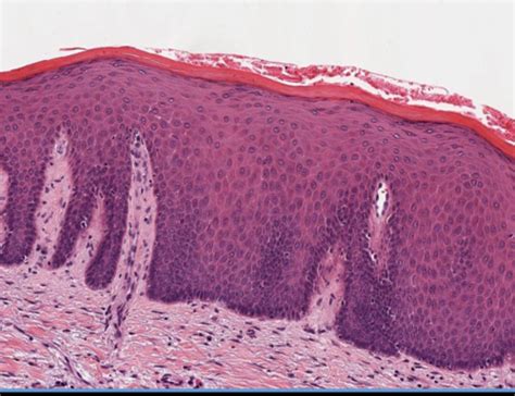 Histology Part 1 Epithelial Flashcards Quizlet