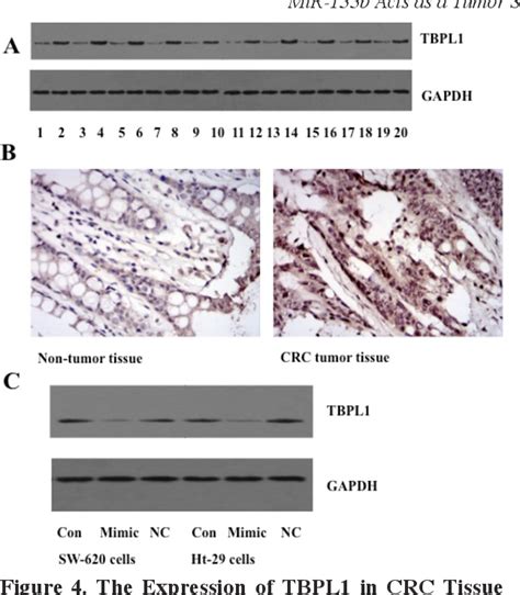 Figure From Mir B Acts As A Tumor Suppressor And Negatively