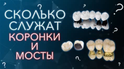 Сколько служат коронки и мосты. Главный миф. - YouTube