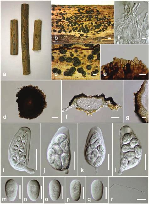 Muyocopron Dipterocarpi Holotype Ac Superficial Ascomata On