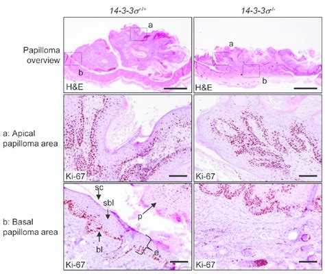 Morphology Of Dmba Tpa Induced Epidermal Tumors In Mice With Varying