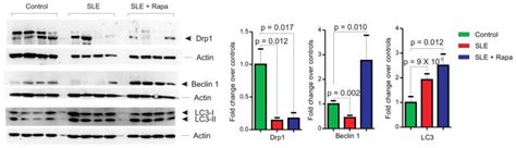 Assessment Of Drp1 Beclin 1 And Lc3 Expression Relative To β Actin By