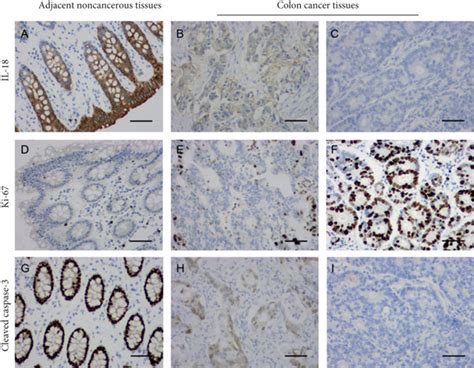 Immunohistochemical Staining Of Il Ki And Cleaved Caspase