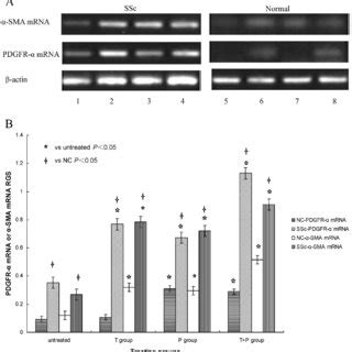 A Pdgfr A And A Sma Mrna Expression Stimulated With Tgf B And