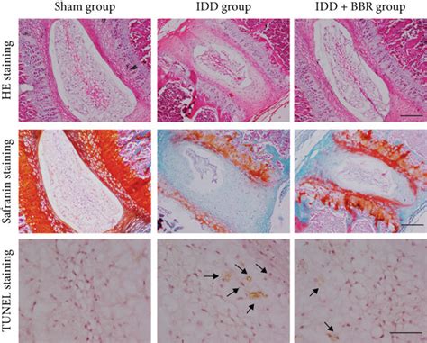 Berberine Ameliorates Intervertebral Disc Degeneration In Vivo Ac