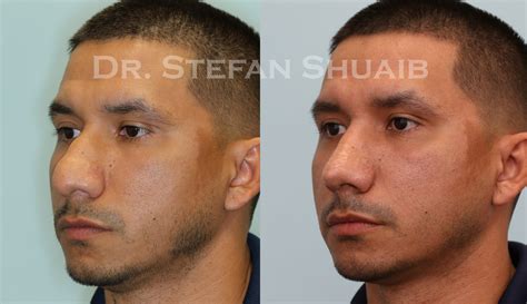 42 Dallas Facial Plastic Surgery Center