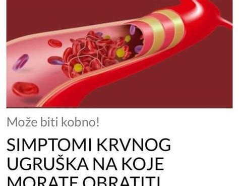 Pogledajte Simptomi Krvnog Ugru Ka Na Koje Morate Obratiti Pa Nju