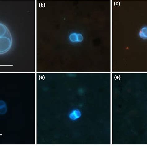 Appearance Of T Gondii Oocysts And Oocyst Like Structures Visualized